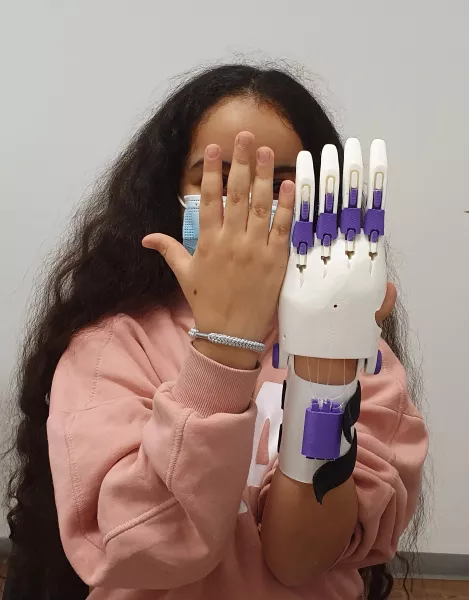 Impression 3D: La première prothèse de main à 50 euros débarque en